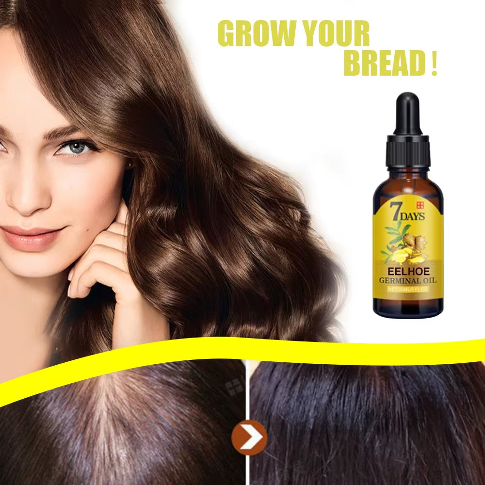 Ginger Hair Growth Oil | Natural Essential Anti-Hair Loss Treatment | Hydrating Nutrient Solution for All Hair Types 40Ml
